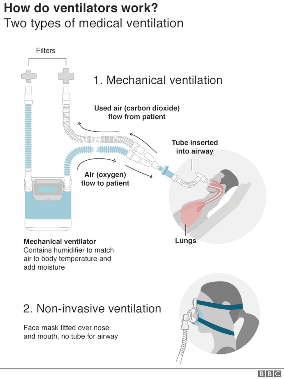 _111484691_covid19-ventilator_3-nc